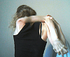 hypermobile shoulder