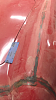 Epoxy Filled Seams